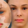 Витилиго&nbsp;се лекува с хормонална&nbsp;терапия
