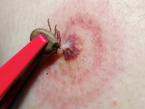 Бърза помощ ни нахока, че ходим за кърлеж