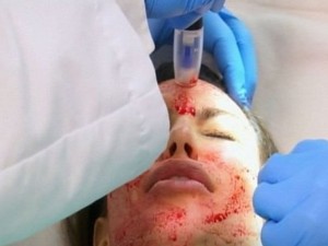 Подмладяват с кръв от юноши срещу $8000
