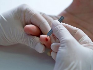 Роми сеят хепатит в Града на тепетата