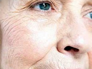 Бръчките говорят за здравето ни
