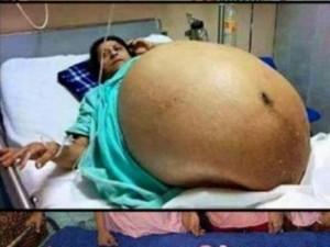 Жена роди 11 деца за броени минути
&nbsp;