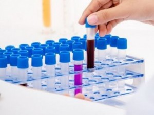 Българите под заплаха от хепатит E
 