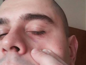 Ало, джендърите на Сорос, ами битите мъже?