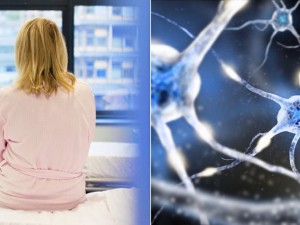 Множествената склероза посяга по-често на жените
