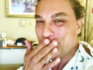 Оперираха Освалдо Риос от тумор в простатата