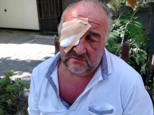 Зловещо! Братовчед ми ослепя напълно след два жестоки побоя. Удряли го с електрошокова палка и бокс, бил целият в кръв