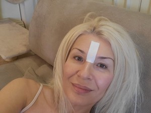 Гала бори дълбоките бръчки с тиксо
 