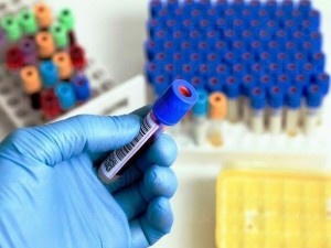 Ето с кои изследвания да открием рака
 