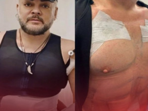 Филип Киркоров си сложи гърди