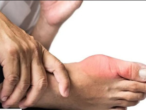 Изпитани народни средства срещу подагра 
