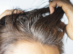 Сивите коси предпазват от меланом
