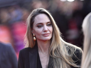 Анджелина Джоли показа белезите си
